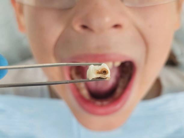 Best Pediatric Emergency Dentist in West Point, NY